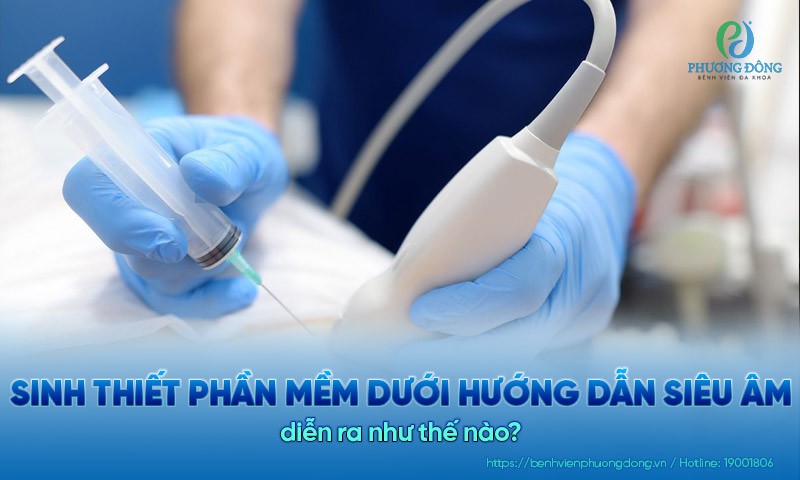 Khi nào bác sĩ chỉ định sinh thiết u vú dưới hướng dẫn siêu âm?
