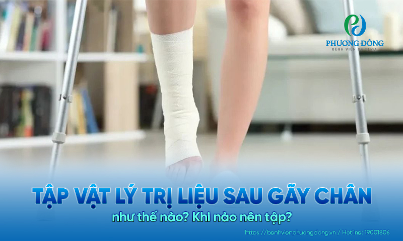 Tập vật lý trị liệu sau gãy chân như thế nào? Khi nào nên tập?