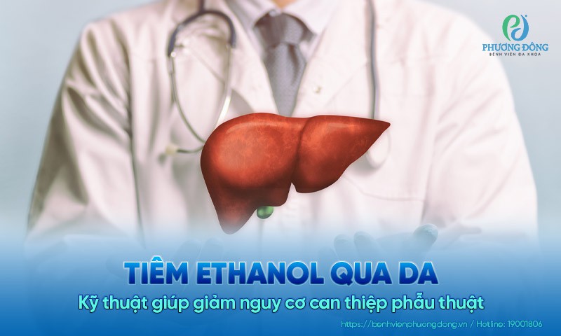Giảm nguy cơ can thiệp phẫu thuật nhờ kỹ thuật tiêm ethanol qua da
