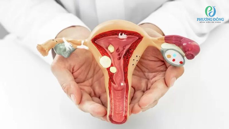 Một số bệnh lý phụ khoa có thể ảnh hưởng đến chu kỳ kinh nguyệt nữ giới