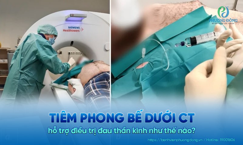 Tiêm phong bế dưới CT hỗ trợ điều trị đau thần kinh như thế nào?