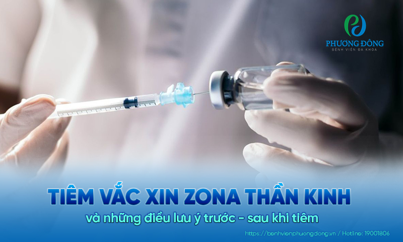 Tiêm vắc xin zona thần kinh và những điều lưu ý trước - sau khi tiêm 