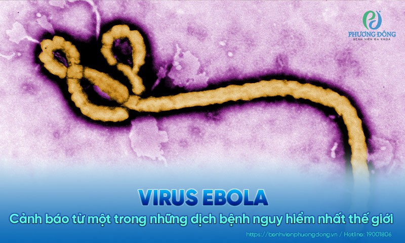 Virus Ebola: Cảnh báo từ một trong những dịch bệnh nguy hiểm nhất thế giới