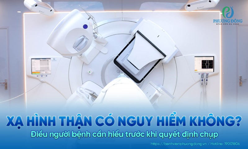 Xạ hình thận có nguy hiểm không? Điều người bệnh cần hiểu trước khi quyết định chụp