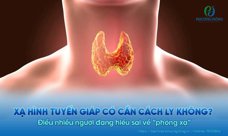 Xạ hình tuyến giáp có cần cách ly không? Điều nhiều người đang hiểu sai về “phóng xạ”