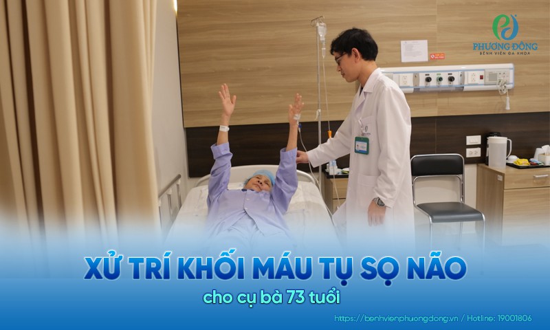 Xử trí khối máu tụ sọ não cho cụ bà 73 tuổi  
