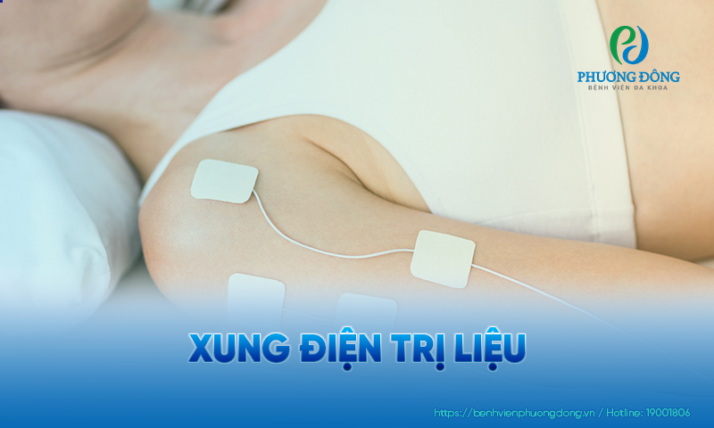 Xung điện trị liệu có tác dụng như thế nào? Có an toàn không?