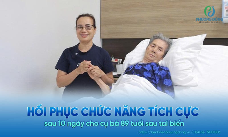 Hồi phục chức năng tích cực sau 10 ngày cho cụ bà 89 tuổi sau tai biến