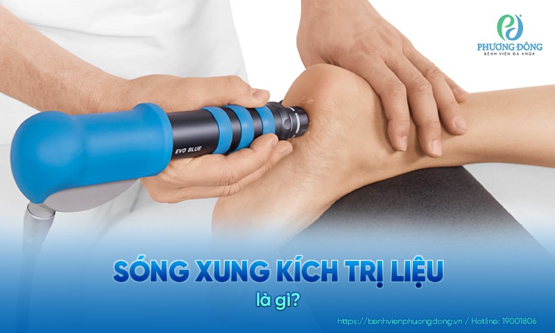 Sóng xung kích trị liệu: Lợi ích, chỉ định và chống chỉ định