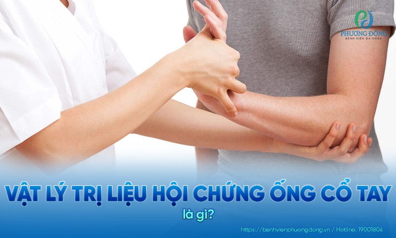 Vật lý trị liệu hội chứng ống cổ tay: Các bài tập và lưu ý chăm sóc