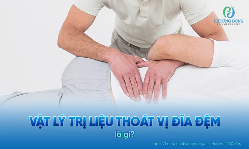 Vật lý trị liệu thoát vị đĩa đệm có hiệu quả không? Các liệu pháp phổ biến