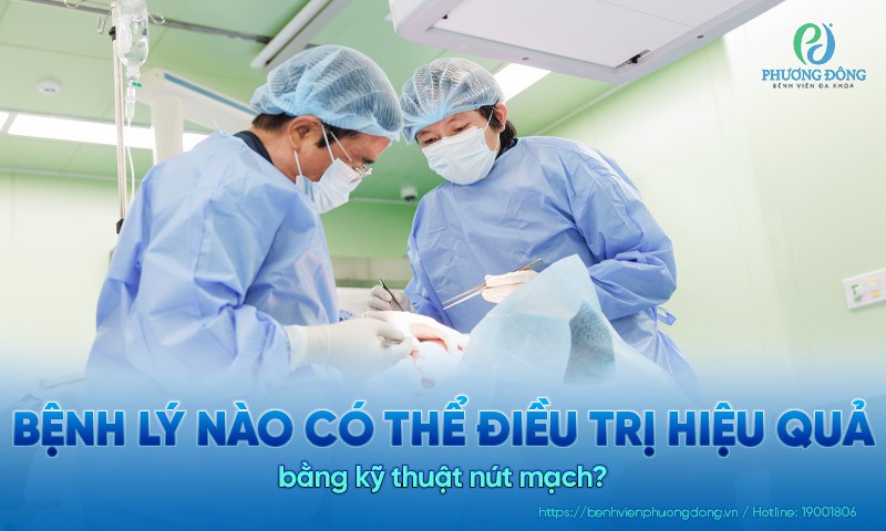 Bệnh lý nào có thể điều trị hiệu quả bằng kỹ thuật nút mạch?