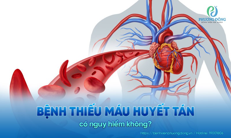 Bệnh thiếu máu huyết tán có nguy hiểm không?