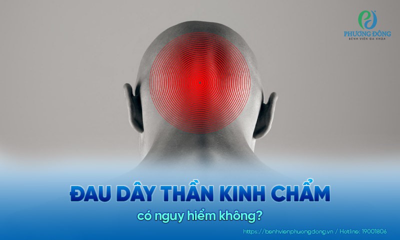 Đau dây thần kinh chẩm có nguy hiểm không?