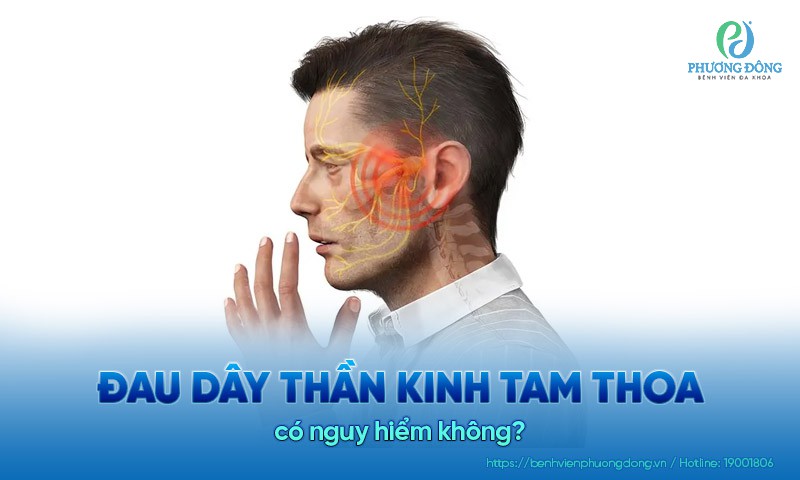 Đau dây thần kinh tam thoa có nguy hiểm không​?