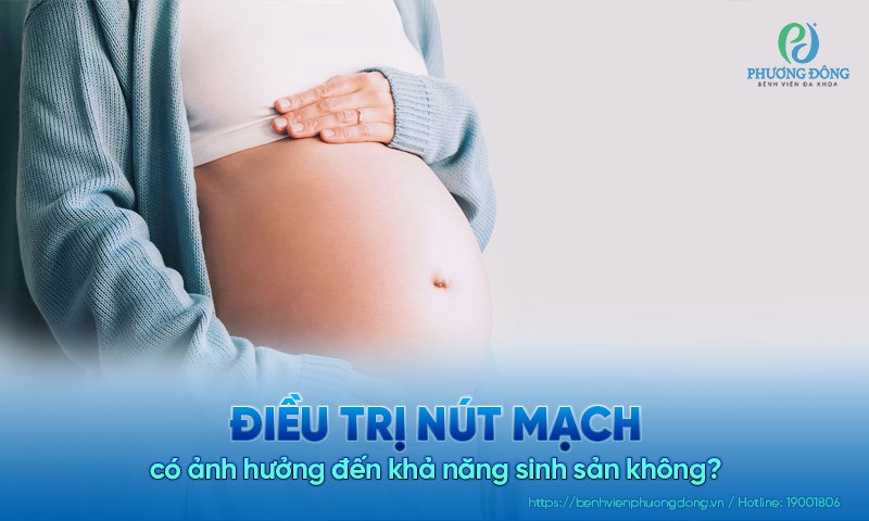 Điều trị nút mạch có ảnh hưởng đến khả năng sinh sản không?