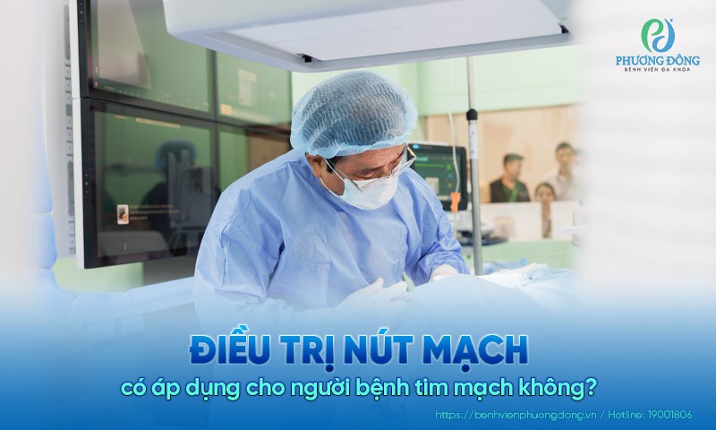 Điều trị nút mạch có áp dụng cho người bệnh tim mạch không?