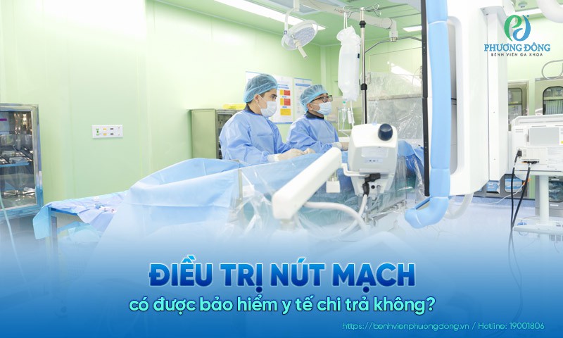 Điều trị nút mạch có được bảo hiểm y tế chi trả không?