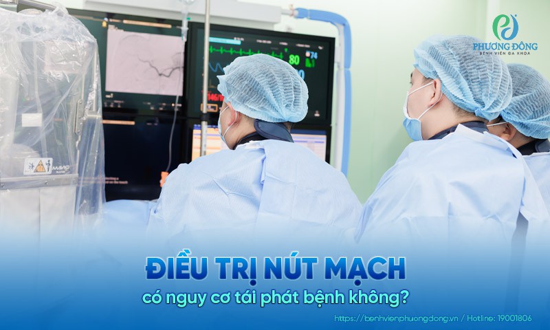 Điều trị nút mạch có nguy cơ tái phát bệnh không?