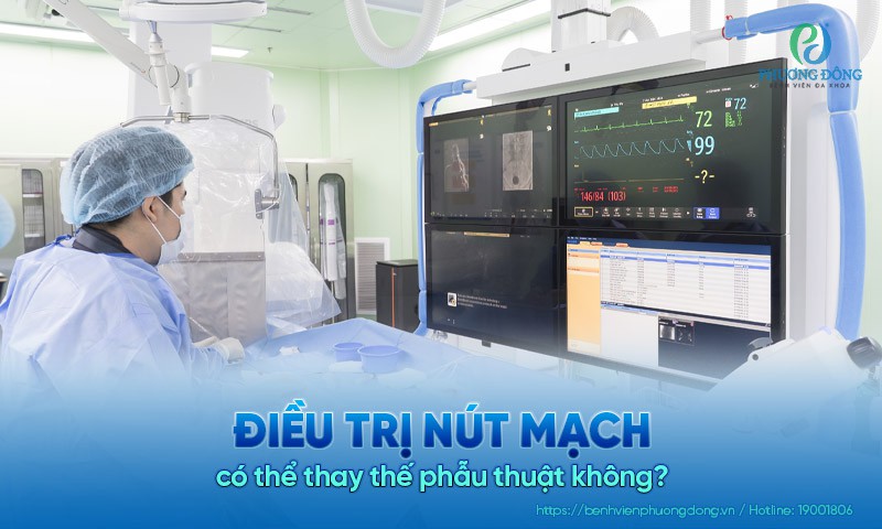 Điều trị nút mạch có thể thay thế phẫu thuật không?