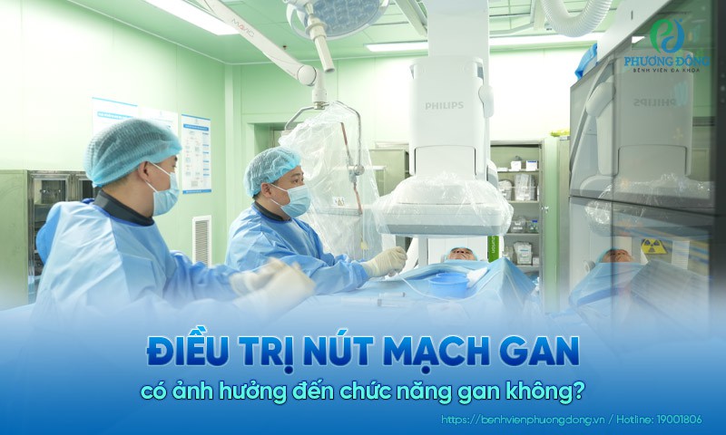 Điều trị nút mạch gan có ảnh hưởng đến chức năng gan không?