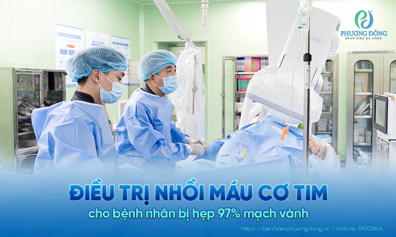 Điều trị nhồi máu cơ tim cho bệnh nhân bị hẹp 97% mạch vành