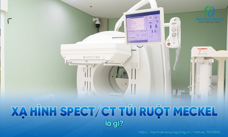 Phát hiện sớm túi ruột Meckel nhờ Xạ hình SPECT/CT hiện đại