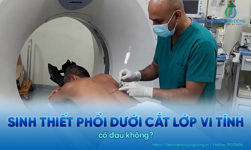 Sinh thiết phổi dưới cắt lớp vi tính có đau hay nguy hiểm không?
