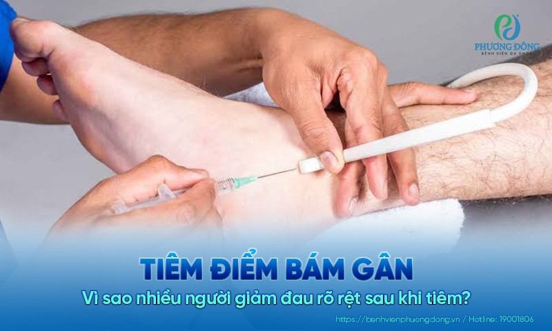 Vì sao nhiều người giảm đau rõ rệt sau khi tiêm điểm bám gân?