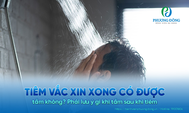 Tiêm vắc xin xong có được tắm không? Phải lưu ý gì khi tắm sau khi tiêm 