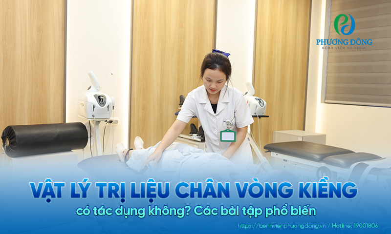 Vật lý trị liệu chân vòng kiềng có tác dụng không? Các bài tập phổ biến 
