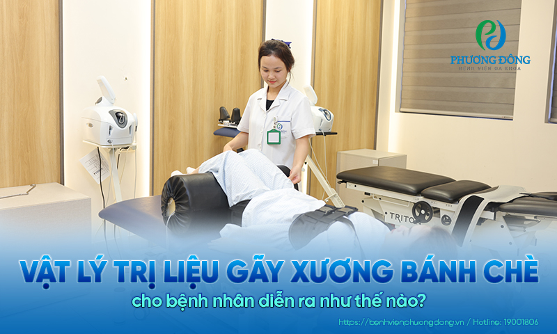 Vật lý trị liệu gãy xương bánh chè cho bệnh nhân diễn ra như thế nào?