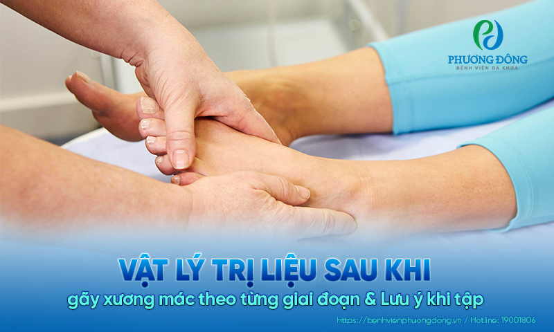 Vật lý trị liệu sau khi gãy xương mác theo từng giai đoạn & Lưu ý khi tập 