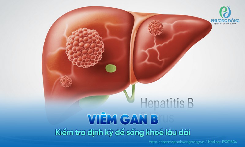 Viêm gan B: Kiểm tra định kỳ để sống khoẻ lâu dài