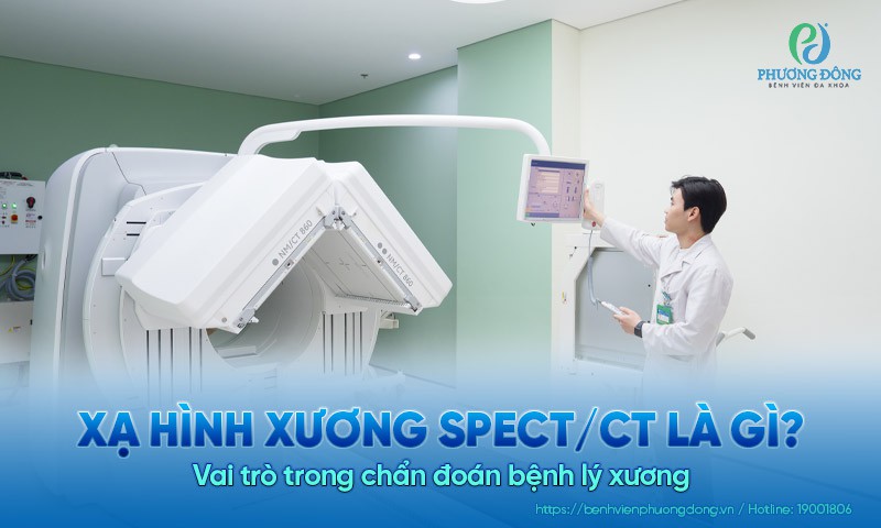 Xạ hình xương SPECT/CT là gì? Vai trò trong chẩn đoán bệnh lý xương