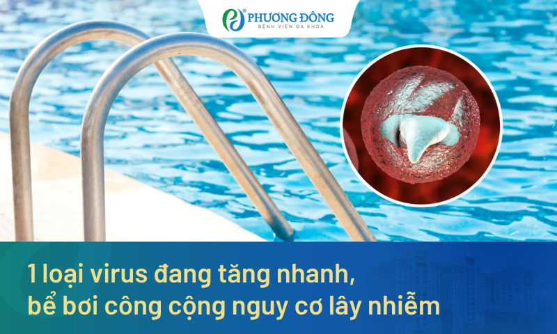1 loại virus đang tăng nhanh, bể bơi công cộng nguy cơ lây nhiễm: Bác sĩ cảnh báo dấu hiệu trẻ mắc bệnh, phụ huynh đừng chủ quan