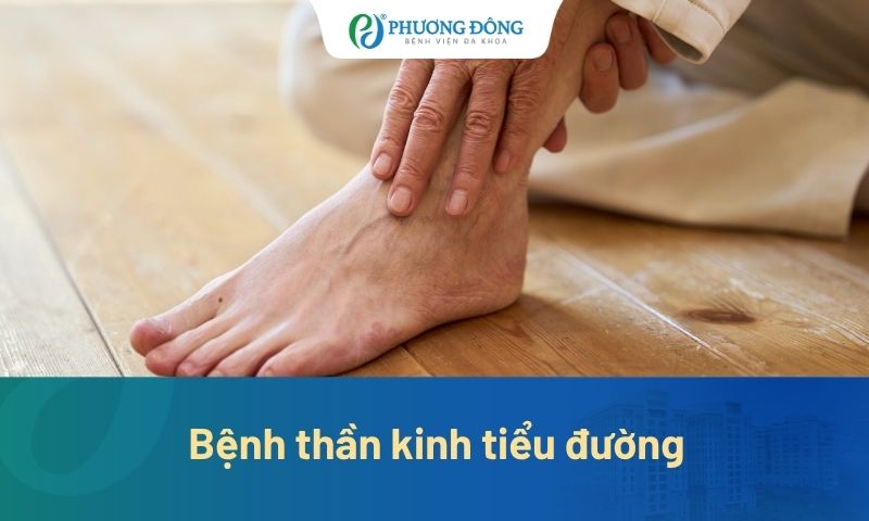 Bệnh thần kinh tiểu đường: Dấu hiệu, nguyên nhân và cách điều trị