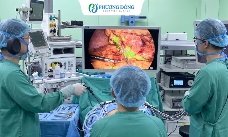 “Bản đồ hạch phát sáng” bằng ICG: Công nghệ hỗ trợ nâng cao độ chính xác trong phẫu thuật ung thư tiêu hóa tại Phương Đông 