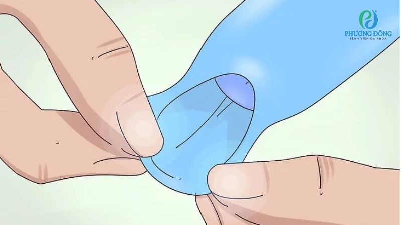 Bé 5 tháng tách bao quy đầu có sớm quá không?