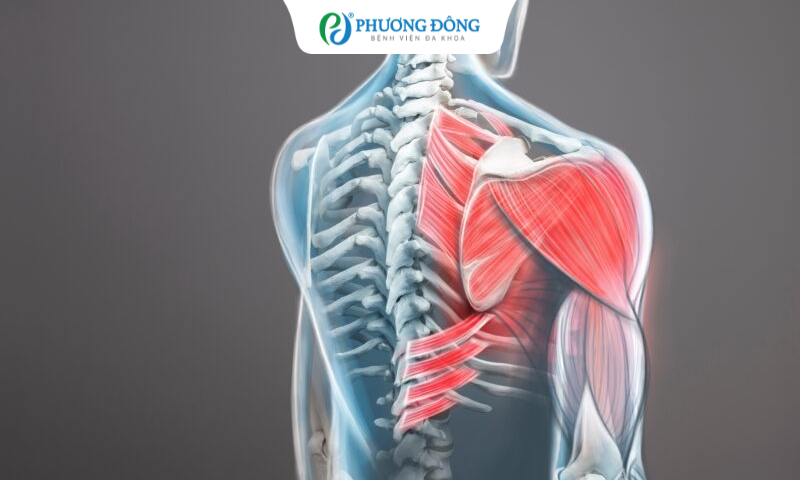 Đau giữa lưng khu vực khuỷu vai