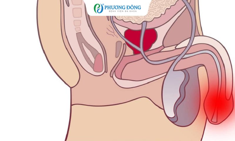 Bị đứt dây hãm bao quy đầu có sao không?