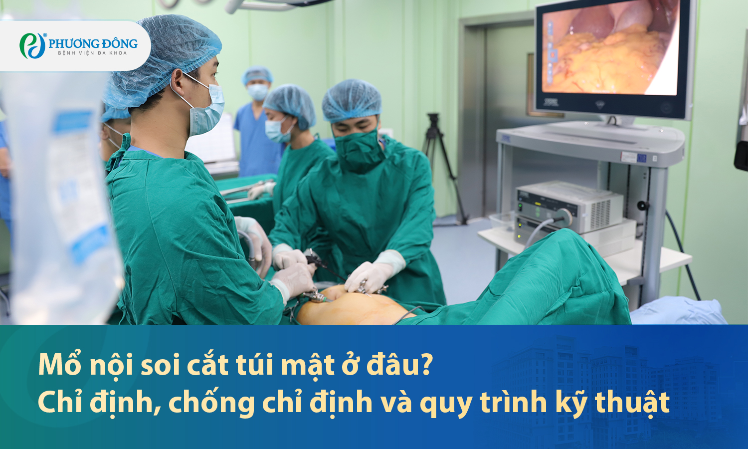 Mổ nội soi cắt túi mật ở đâu? Chỉ định, chống chỉ định và quy trình kỹ thuật