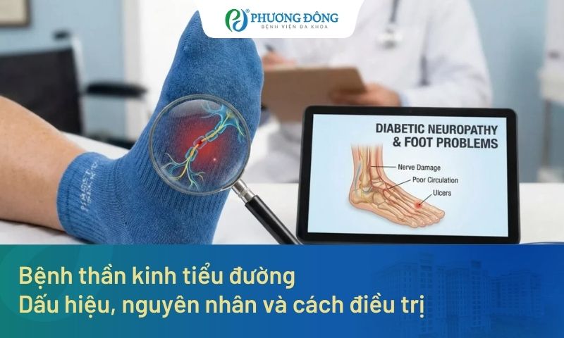 Bệnh thần kinh tiểu đường: Dấu hiệu, nguyên nhân và cách điều trị 