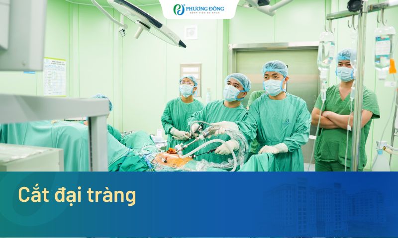 Cắt đại tràng khi nào? Quy trình kỹ thuật và phương pháp