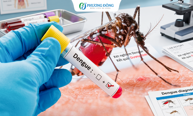 Hạ sốt không đồng nghĩa khỏi bệnh: Sai lầm khiến nhiều ca sốt xuất huyết diễn tiến nguy kịch
