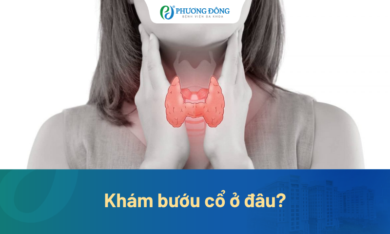 [Giải đáp] Khám bướu cổ ở đâu tốt?