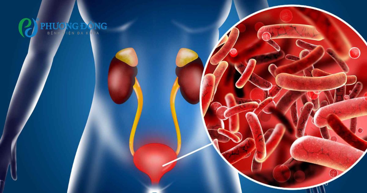 Cháu bị viêm tiết niệu tái lại suốt thì sao bác sĩ?