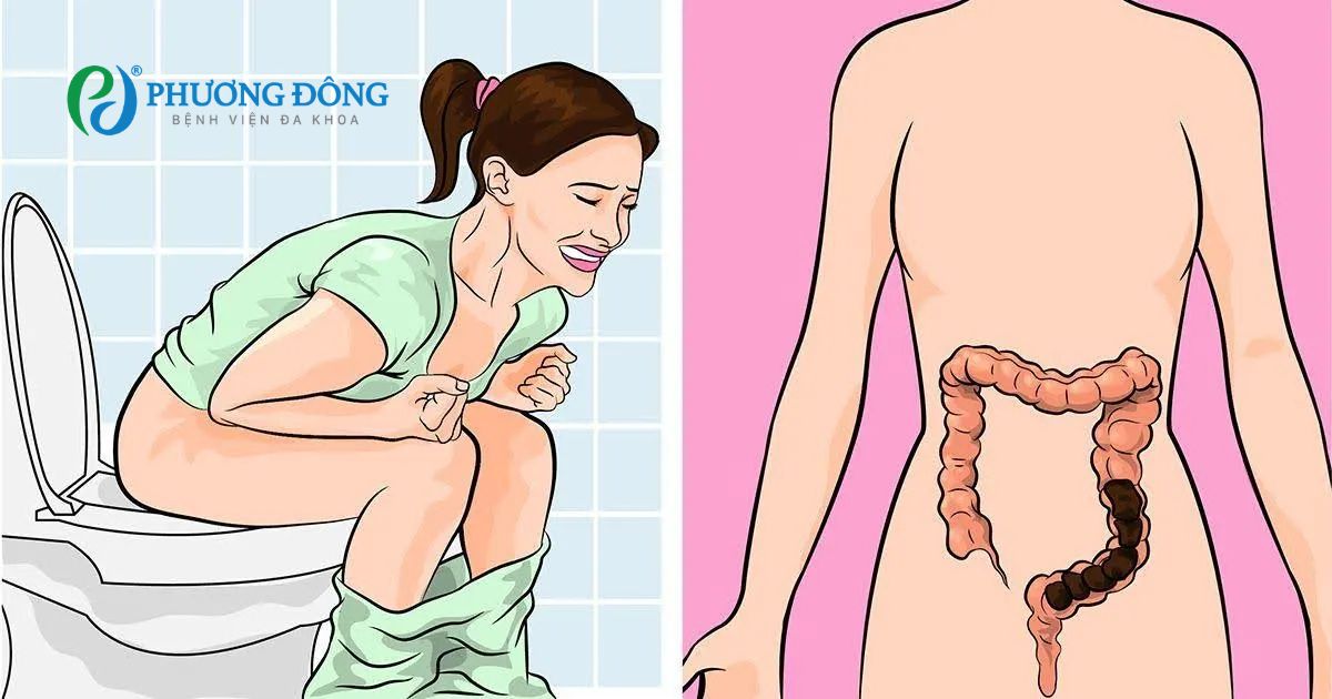 Ít đi nặng có gặp vấn đề gì không bác sĩ?