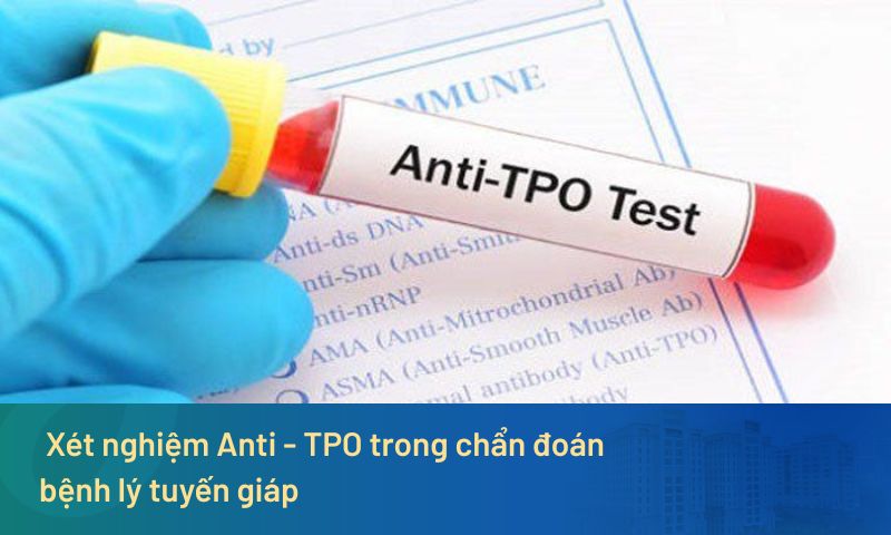 Tầm quan trọng của xét nghiệm Anti - TPO trong chẩn đoán bệnh lý tuyến giáp