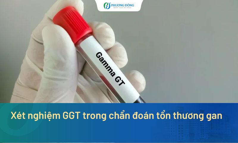 Xét nghiệm GGT trong chẩn đoán tổn thương gan